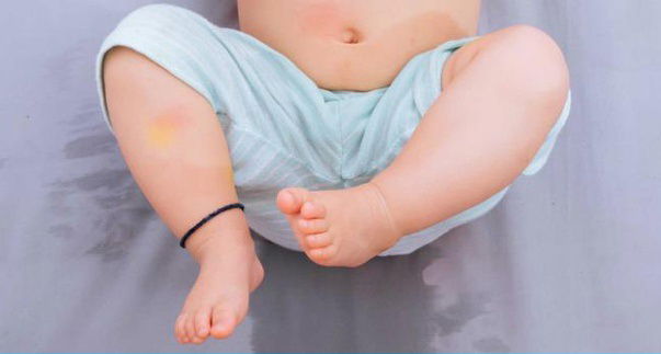 Xót xa bé trai ở Vũng Tàu mắc bệnh hiếm gặp, cả thế giới chỉ có 36 ca