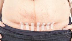 Khỏe đẹp sau sinh