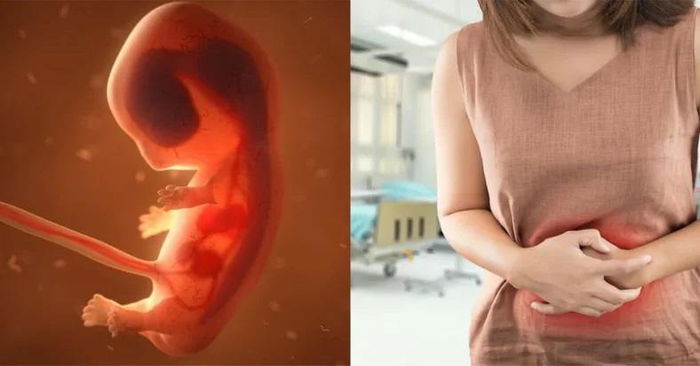 Thai ngoài tử cung: Nỗi lo lắng của mẹ ở thai kỳ đầu tiên