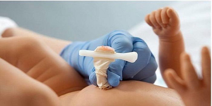 Sản phụ sinh con tại nhà, bà cắt rốn cho cháu bằng thanh nứa khiến bé sơ sinh nguy kịch