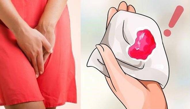 Ra máu tươi sau sinh có thể gây nguy hiểm tới tính mạng