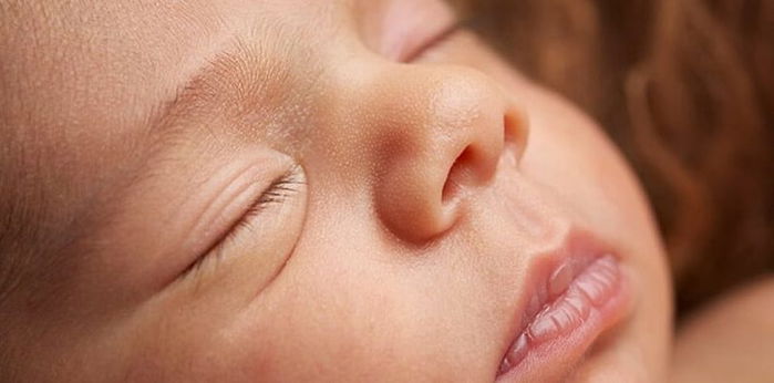 Trẻ sơ sinh môi thâm có thể do những nguyên nhân này