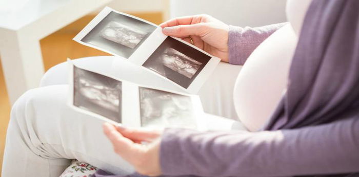 USG kehamilan tak selamanya akurat, ini 4 kesalahan yang kerap dilakukan dokter