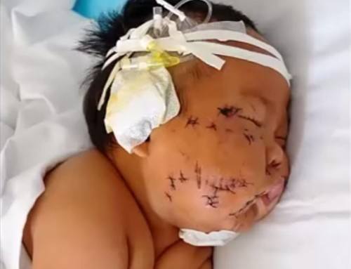 Bayi 8 Bulan Ditusuk 90 kali Gara-gara Gigit Puting Ibu