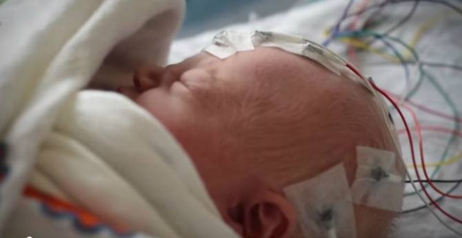 Bayi Baru Lahir Ternyata Juga Merasakan Sakit Seperti Orang Dewasa