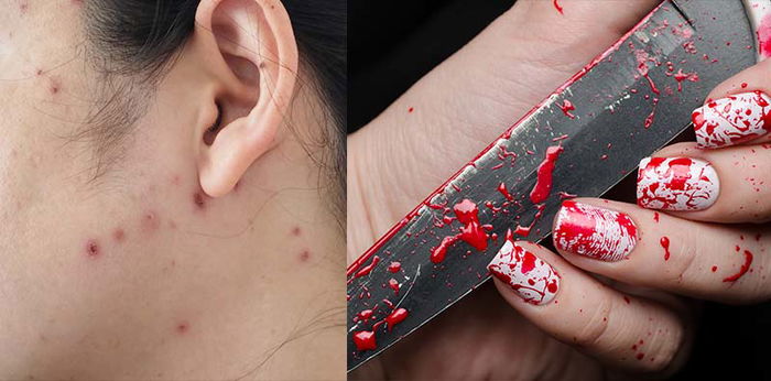 Ngeri! Wanita ini tertular virus HIV karena berbagi alat manicure