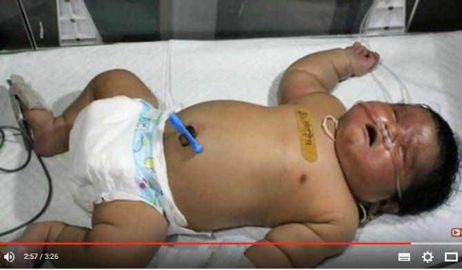 Bayi Terbesar di India Seberat 6,6 Kg Lahir Normal Hanya Dalam Waktu 15 Menit