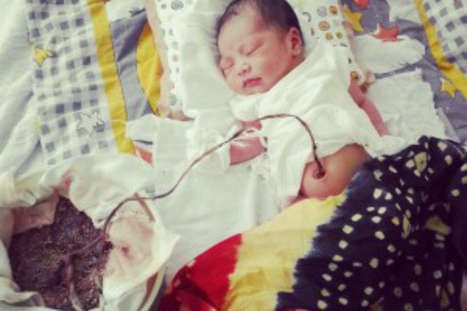 Lotus Birth, Melahirkan Tanpa Memotong Tali Pusat Amankah?