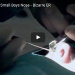 Lego Masuk ke Hidung Anak 4 Tahun