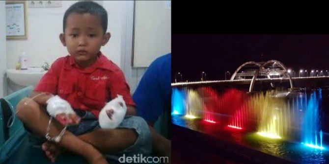 Ayah Sibuk Dengan Gadget, 2 Jari Anak Putus di Jembatan Kenjeran