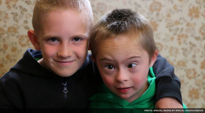 Punya Adik Down Syndrome, Hubungan Dua Saudara Ini Amat Menyentuh