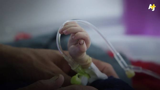 Ratusan Bayi Jadi Korban Perang di Afghanistan Setiap Bulannya [Video]