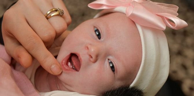 Ajaib! Saat Dilahirkan, Bayi ini Langsung Punya Dua Gigi