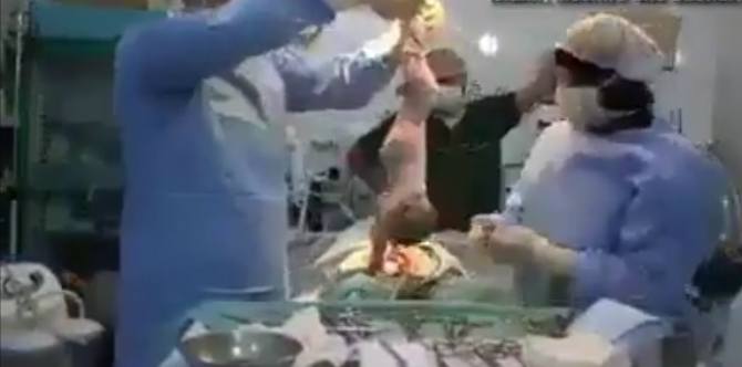 Teknik Resusitasi Kardiopulmonal Mengembalikan Denyut Jatung Bayi ini [Video]