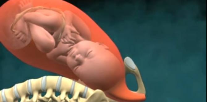 Parents, lihat video melahirkan melalui persalinan normal (Vaginal Birth) ini