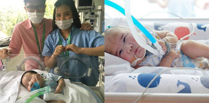 Kegigihan Adam Fabumi, Pejuang Cilik yang Lawan Banyak Penyakit Langka