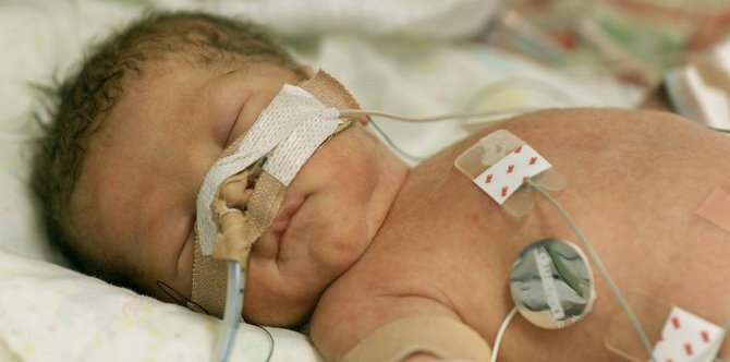 Risiko fatal pada Bayi baru lahir jika memaksakan ASI eksklusif saat Ibu tak mampu