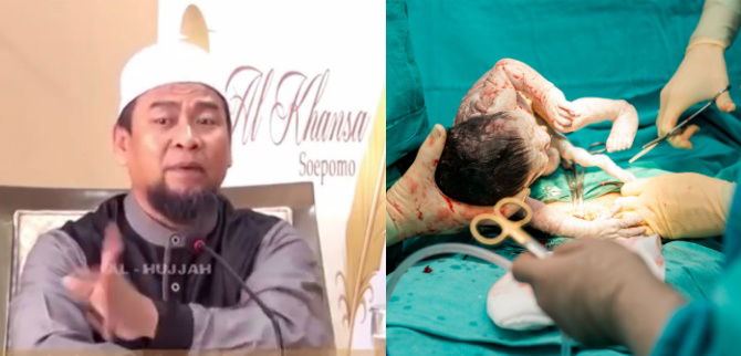 Soal Video Ceramah "Operasi Cesar Karena Gangguan Jin", Ini Kata Bidan dan Dokter Kandungan
