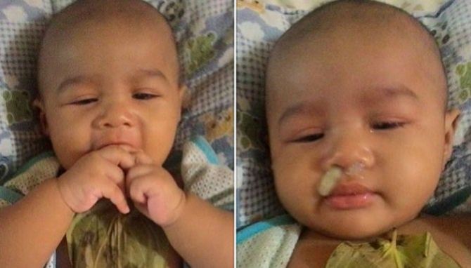 Daun Sirih, cara tradisional mengatasi hidung tersumbat pada anak