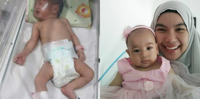 Terkena demam berdarah saat hamil, ibu dan bayinya ini hampir kehilangan nyawa
