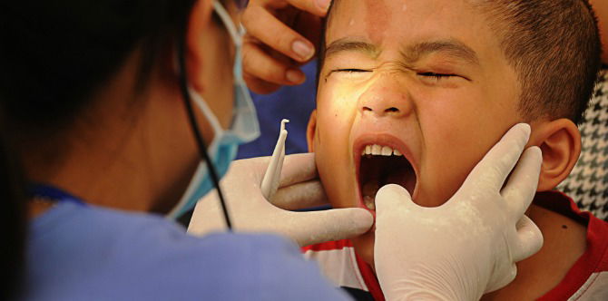 Kisah tragis anak ini menyadarkan orangtua agar tidak sepelekan gigi anak berlubang