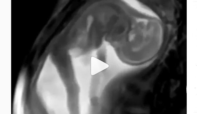 Parents mau tahu bagaimana gerakan bayi dalam kandungan? Lihat video ini!