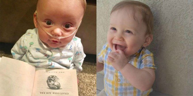 Ketuban bocor di usia kandungan 6 bulan, bayi ini hampir digugurkan atas saran dokter