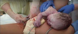 Melahirkan bayi kembar tiga, ibu ini jalani persalinan normal