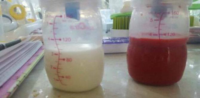 5 Foto kondisi ASI berdarah, bukti kalau menyusui tidaklah mudah!