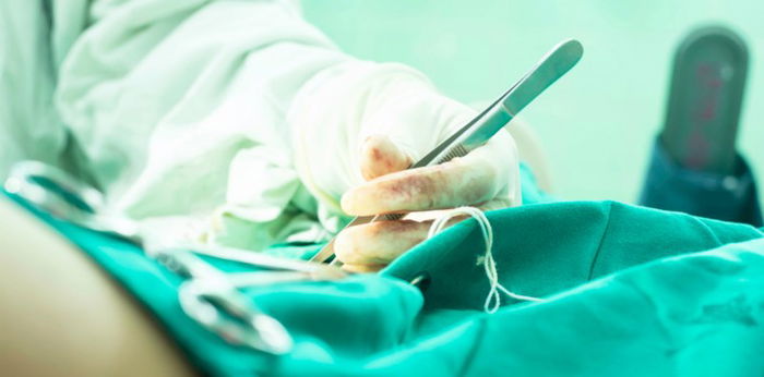 Patahan jarum 3 cm tertinggal di vagina pasca melahirkan, ibu ini harus dioperasi lagi