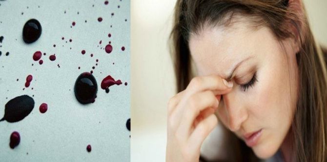 7 Penyebab Darah Haid Berwarna Hitam, Perlukah Merasa Khawatir?