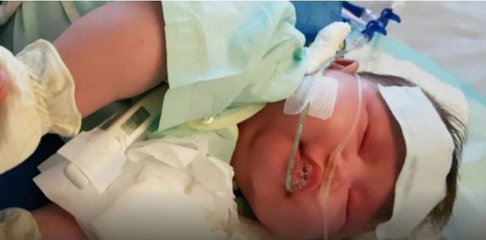 Bayi 3 bulan alami kejang 30 kali sehari, ternyata ini penyebabnya