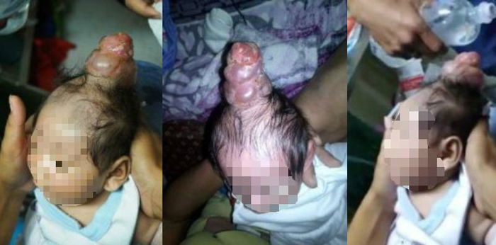 Bayi ini lahir dengan tanduk di kepala seperti unicorn, apa penyebabnya?