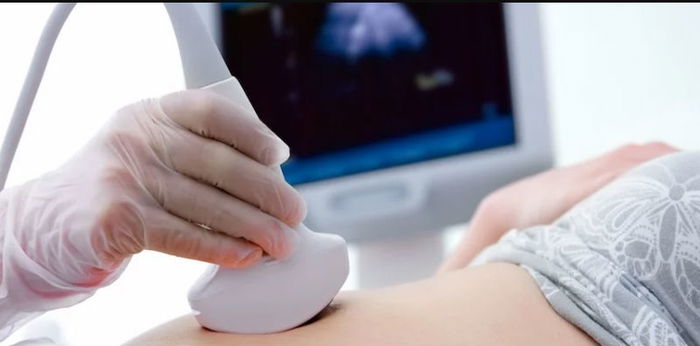 USG 4 Dimensi, wajibkah dilakukan ibu hamil? Ini penjelasan ahli kandungan