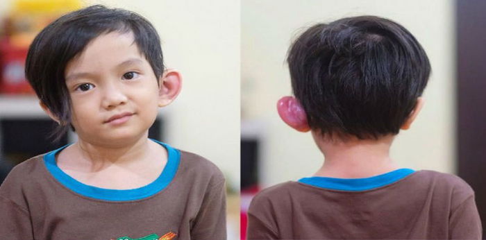 Dibilang congean, Saga anak pertama Anji beri informasi soal sinus preauricular
