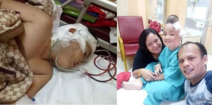 "Papa Mama jangan sedih, aku kuat..." Kisah perjuangan korban bom Samarinda,