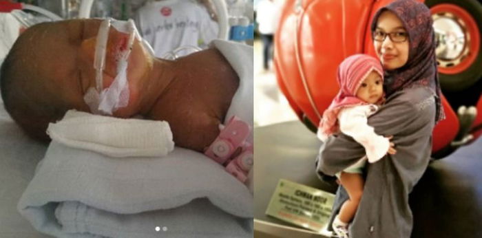 Ibu ini berbagi kisah suka duka merawat bayinya yang lahir prematur