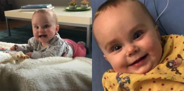 Tangan kanan mendadak lumpuh, bayi terserang penyakit langka mirip polio