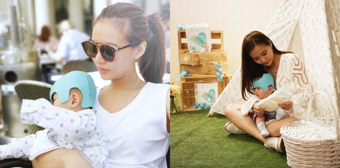 Kepala bayi peyang, ibu ini berbagi tips anak memakai helm terapi