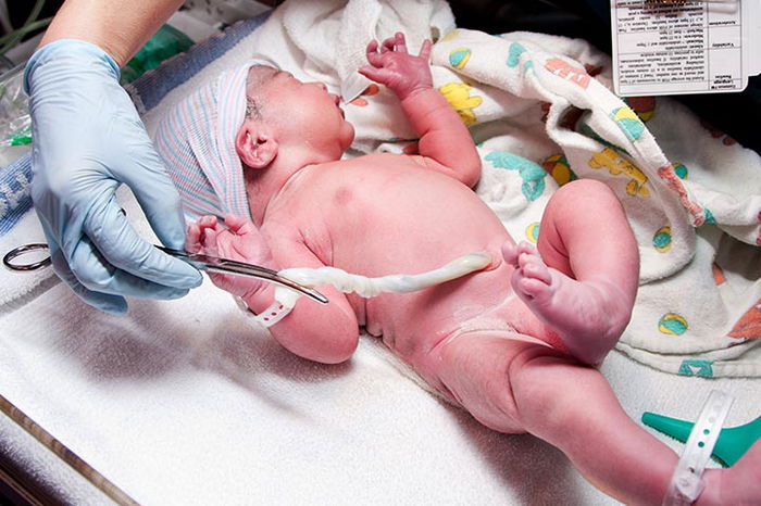 Bunda ketahuilah 5 fakta menarik dari tali pusar bayi