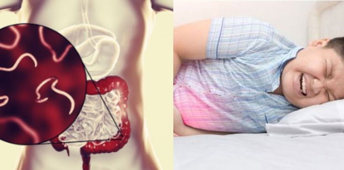 Anak Cacingan? Ini Cara Memilih Obat Cacing yang Tepat Menurut Dokter