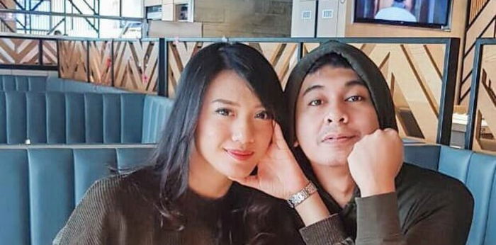 Alami gigi berlubang saat hamil, istri Raditya Dika dilarang tambal gigi