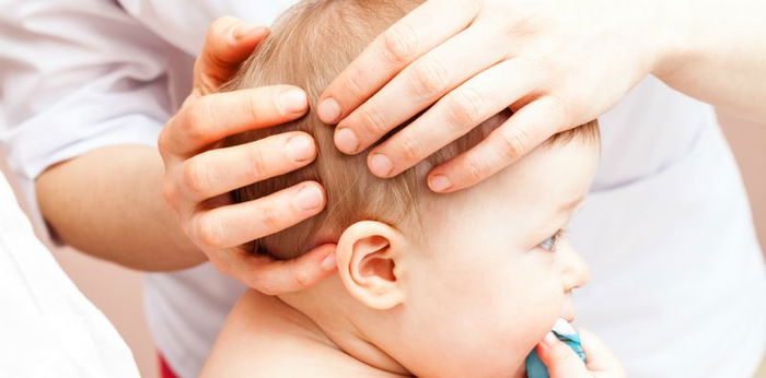 Waspadai sindrom kepala datar pada bayi, bisa menghambat tumbuh kembang motoriknya
