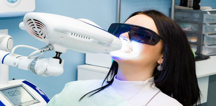 Ingin memutihkan gigi secara instan? Waspadai 5 efek samping bleaching gigi