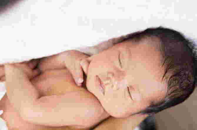 hipotiroid pada bayi 3 hipotiroid pada bayi