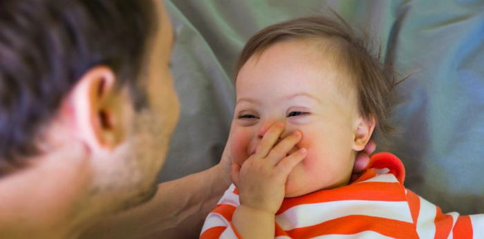 5 Kelainan kromosom pada bayi yang harus diwaspadai ibu hamil, ini cara deteksinya