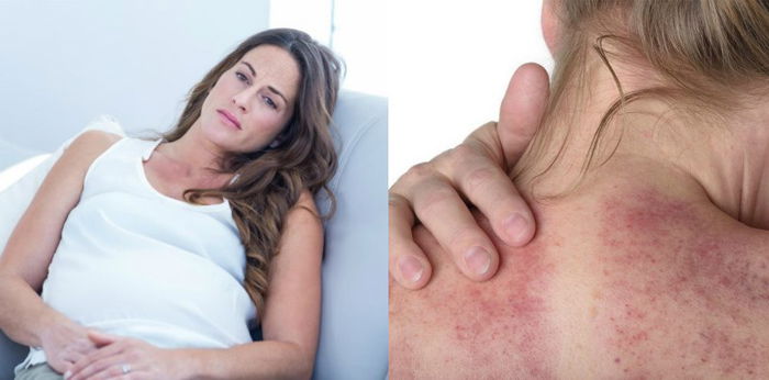 Kerokan Saat Hamil, Bolehkah untuk Bumil dan Apa Saja Bahayanya?