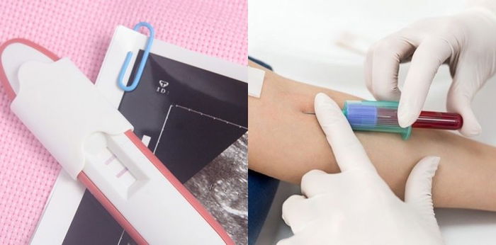 Tes urin dan darah untuk mengetahui kehamilan, mana yang lebih akurat?