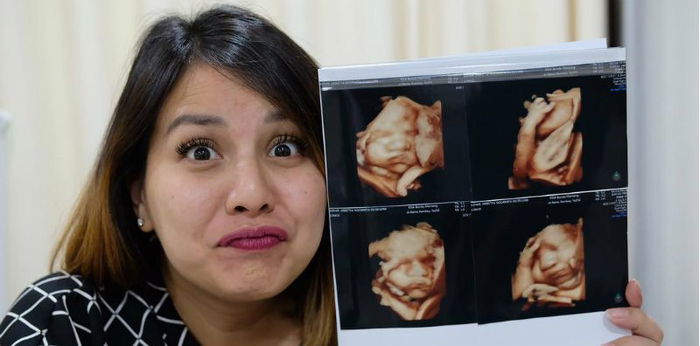Ingin tahu perkembangan organ janin lebih detail, Tya Ariestya lakukan USG 4D
