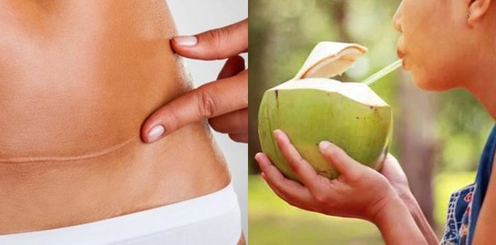 Benarkah Setelah Caesar Tak Boleh Minum Air Kelapa? Ini Penjelasannya!